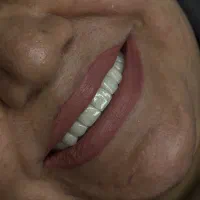 نیازمند دستیار دندانپزشک  و پذیرش منشی