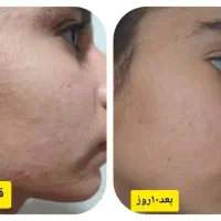 مشاوره رایکان پوست و مو ،درمان لک و ...|آرایشی، بهداشتی، درمانی|رشت, دروازه لاکان|دیوار