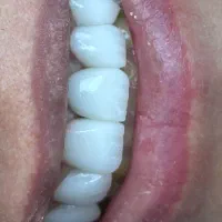 دندانپزشکی در آخونی|خدمات آرایشگری و زیبایی|تبریز, |دیوار