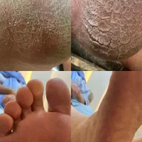 پدیکور درمانی و تخصصی