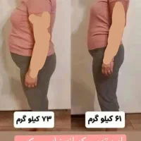 آگهی لاغری|آرایشی، بهداشتی، درمانی|گرگان, |دیوار