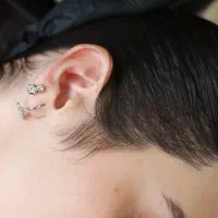 رفع کم پشتی مو با میکرو اسکالپ سر|خدمات آرایشگری و زیبایی|نسیم‌شهر, |دیوار