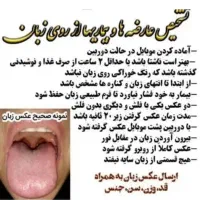 درمان ریزش مو کاملا گیاهی