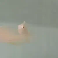 هکلی آلبینو