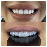 دندانپزشکی آمور. اقساطی