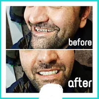 دندان مصنوعی لبخند (ضمانت ۱۰ ساله/تحویل ۳تا ۷ روز)|خدمات آرایشگری و زیبایی|کرج, اصفهانیها|دیوار