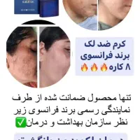 ضدلک لاکچری کوین بدون بازگشت بدون کورتون تضمینی|آرایشی، بهداشتی، درمانی|یاسوج, |دیوار