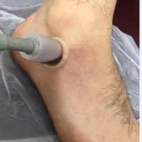 ماساژ درمانی ،کایروپراکتیک ،حجامت،فصد ،زالو درمانی