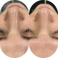 جشنواره پاکسازی پوست