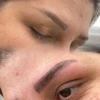 میکروبلیدینگ وفیبروزو نچرال بروز ...