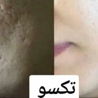 پوست ومو|آرایشی، بهداشتی، درمانی|قم, قم نو|دیوار
