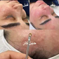فیشیالvipتخصصی درکلینیک برای بانوان واقایان فقط۲۵۰|خدمات آرایشگری و زیبایی|مشهد, آزادشهر|دیوار