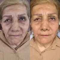 زیبایی ،ژل و بوتاکس وآموزش|خدمات زیبایی و سلامت|تبریز, |دیوار