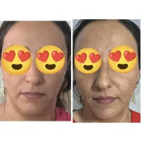 پک جوانساز برای بانوان ۳۰تا ۴۵ سال