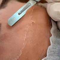 فیشال با تخفیف فوق‌العاده