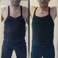 کاهش وزن اصولی و سریع توسط پزشک