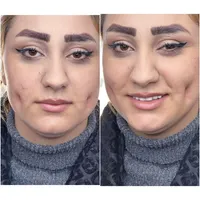 اموزش وخدمات چال گونه وپرسینگ در کلینیک|خدمات آرایشگری و زیبایی|کرمانشاه, |دیوار