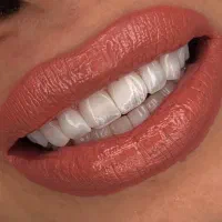 دندانپزشکی کامپوزیت دندان عصب کشی|خدمات آرایشگری و زیبایی|تهران, تهرانپارس غربی|دیوار