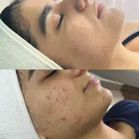 آموزش پاکسازی پوست فیشیال فیشال|خدمات آموزشی|کرمانشاه, |دیوار