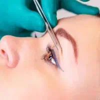 بلفارول پلاستی تخصصی پلک