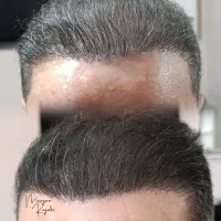 خدمات آقایان بصورت کاملا تخصصی و نچرال