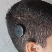 یک دستگاه کاشت حلزون شنوایی گم شده است