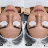 فشیال و پاکسازی با قیمتی ویژه