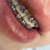دندانپزشکی تخصصی ارتودنسی هرفک 20تومن
