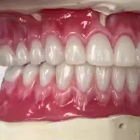 دندانسازی مظفری(محلات در قزوین)یک روزه نقد اقساط