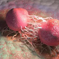 بهبود قطعی و رفع ریشه ای پروستات