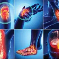 درمان تمامی دردهای مفصلی|خدمات آرایشگری و زیبایی|فومن, |دیوار