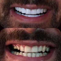 آموزش دندانپزشکی