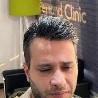 پروتز مو ویژه افراد سخت پسند|خدمات آرایشگری و زیبایی|تهران, حکمت|دیوار
