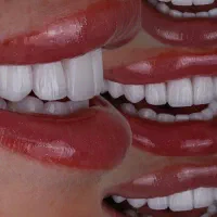 دندان کامپوزیت دندانپزشکی باهوش مصنوعی|خدمات آرایشگری و زیبایی|مشهد, دانشجو|دیوار