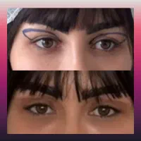 عمل بلفارو وتزریق بوتاکس فیلر وچربی وساکشن غبغب|خدمات آرایشگری و زیبایی|اصفهان, خوراسگان|دیوار