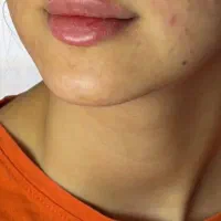 تخفیف و آفرفقط و فقط امروز ویژه پایان تابستان|خدمات زیبایی و سلامت|تهران, صادقیه|دیوار
