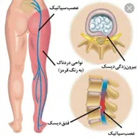 حجامت تخصصی، قلنج گیری ..