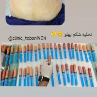 ساکشن وجراحی غبغب|خدمات آرایشگری و زیبایی|کوهدشت, |دیوار