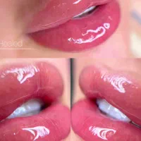 تخفیف ژل بوتاکس مزو آنزیم فیلر غبغب پی ارپی|خدمات آرایشگری و زیبایی|اصفهان, وحید|دیوار