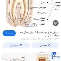 دندان مصنوعی