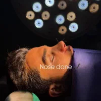 جراحی بینی فقط ۸و۹ آذر فقط۲۹ میلیون تومان