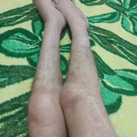 لوازم پزشکی