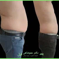 استخدام و آموزش اپراتور دستگاههای لاغری فقط خانم