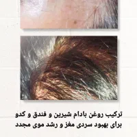 مشاور طب سنتی|خدمات آرایشگری و زیبایی|زابل, |دیوار