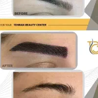 تور جراحی زیبایی قسطی|خدمات آرایشگری و زیبایی|کیش, |دیوار