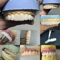 ساخت انواع دست دندان .روکش .لمینت باکیفیت بالا|آرایشی، بهداشتی، درمانی|تهران, مجیدیه|دیوار