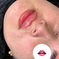 آموزش،پی ار پی مزوبوتاکس بایوفیلر غبغب چربی ساکشن|خدمات آرایشگری و زیبایی|اصفهان, شاهزید|دیوار
