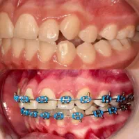 جشنواره ویژه  دندانپزشکی وارتودنسی بدون چک و سفته|خدمات زیبایی و سلامت|تبریز, |دیوار