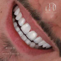 کلینیک دندانپزشکی نیکان|خدمات آرایشگری و زیبایی|تهران, شهرک ابوذر|دیوار