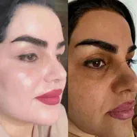 صابون روشن کننده و لایه بردار